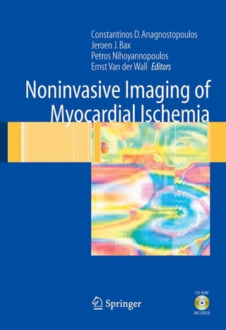 Noninvasive Imaging of Myocardial Ischemia