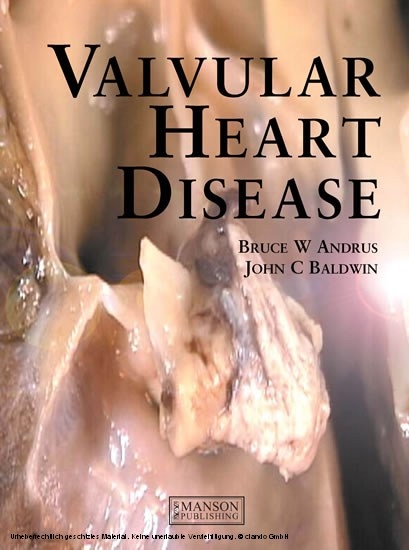 Valvular Heart Disease -  Bruce Andrus,  John Baldwin