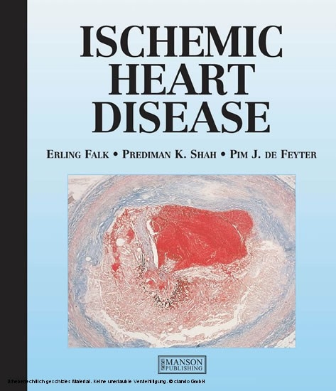 Ischemic Heart Disease -  Erling Falk,  Pim de Feyter,  Prediman Shah