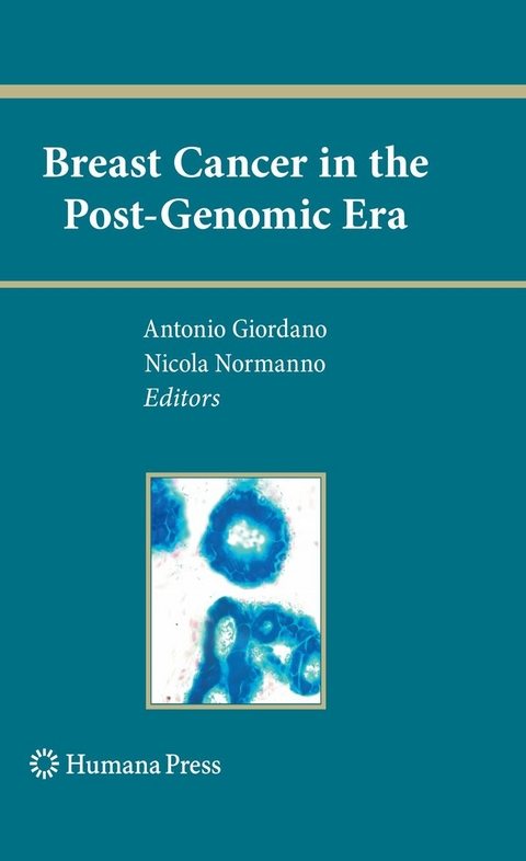 Breast Cancer in the Post-Genomic Era - 
