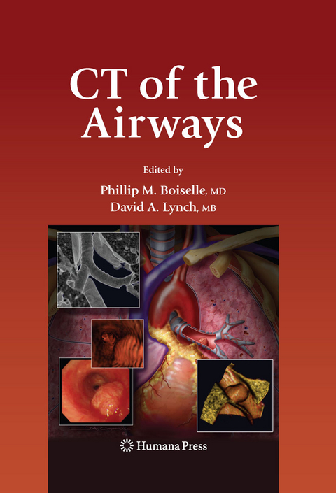 CT of the Airways - 