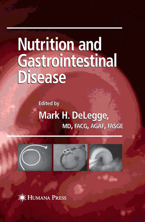 Nutrition and Gastrointestinal Disease - 