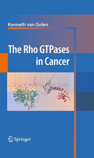 Rho GTPases in Cancer