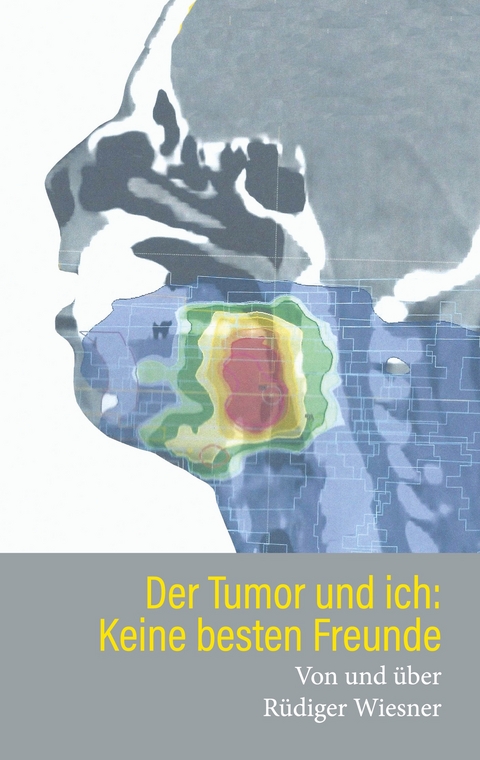 Der Tumor und Ich: Keine besten Freunde - R&uuml;diger Wiesner