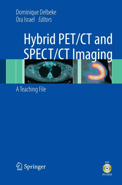 Hybrid PET/CT and SPECT/CT Imaging - 