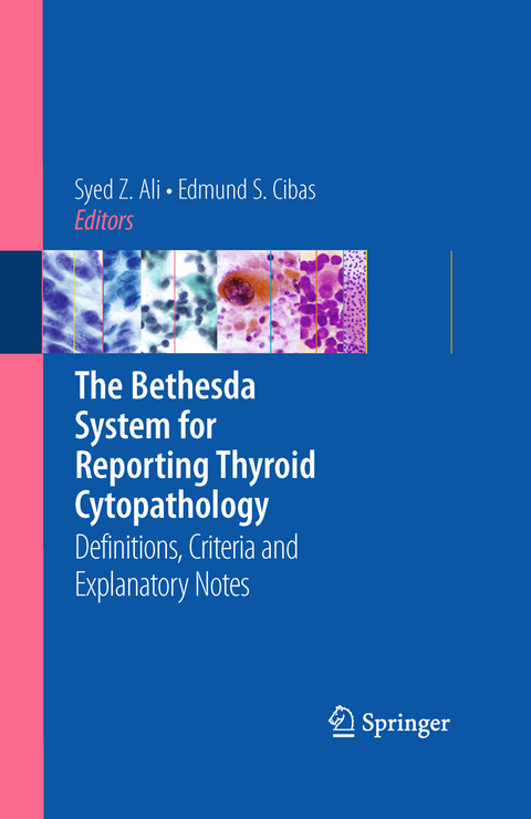 The Bethesda System for Reporting Thyroid Cytopathology - 