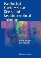 Handbook of Cerebrovascular Disease and Neurointerventional Technique -  Mark R. Harrigan,  John P. Deveikis