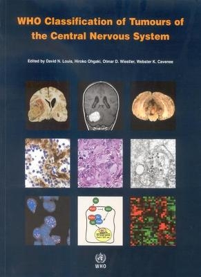 WHO Classification of Tumours of the Central Nervous System
