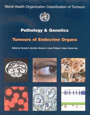 Pathology and genetics of tumours of the endocrine organs -  International Agency for Research on Cancer,  World Health Organization,  International Academy of Pathology