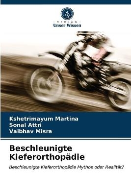 Beschleunigte Kieferorthop&auml;die - Kshetrimayum Martina, Sonal Attri, Vaibhav Misra