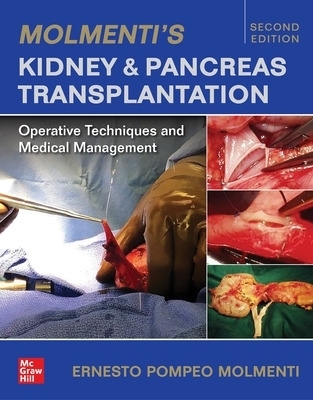 Molmenti's Kidney and Pancreas Transplantation: Operative Techniques and Medical Management - Ernesto P. Molmenti