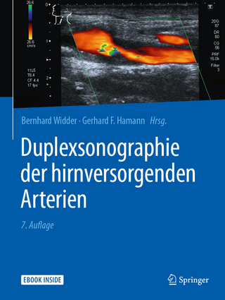 Duplexsonographie der hirnversorgenden Arterien - Bernhard Widder; Gerhard Hamann