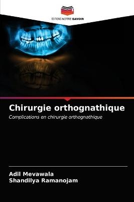 Chirurgie orthognathique - Adil Mevawala, Shandilya Ramanojam