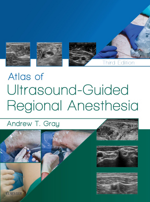 Atlas of Ultrasound-Guided Regional Anesthesia E-Book -  Andrew T. Gray