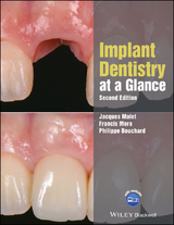 Implant Dentistry at a Glance -  Philippe Bouchard,  Jacques Malet,  Francis Mora