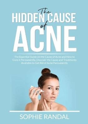 The Hidden Cause of Acne - Sophie Randal