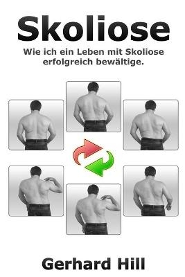 Skoliose - Gerhard Hill