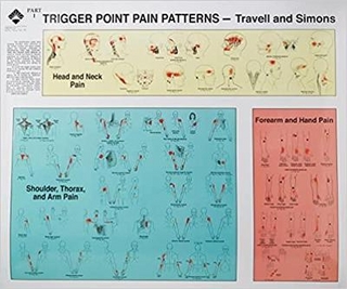 Travell and Simons' Trigger Point Pain Patterns Wall Charts