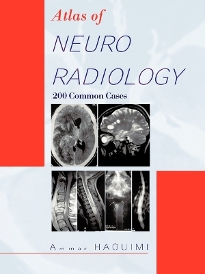 Atlas Of NEURORADIOLOGY - Ammar Haouimi