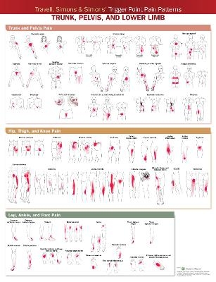 Travell, Simons & Simons’ Trigger Point Pain Patterns Wall Chart - 