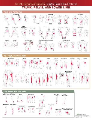 Travell, Simons & Simons&rsquo; Trigger Point Pain Patterns Wall Chart